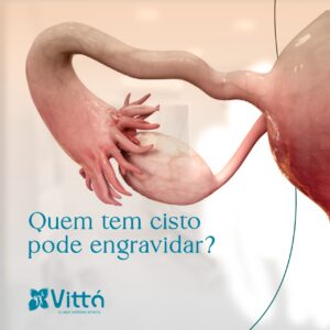 Quem-tem-cisto-pode-engravidar-dra-simone-sampaio-vitta-clinica-sinop-mt